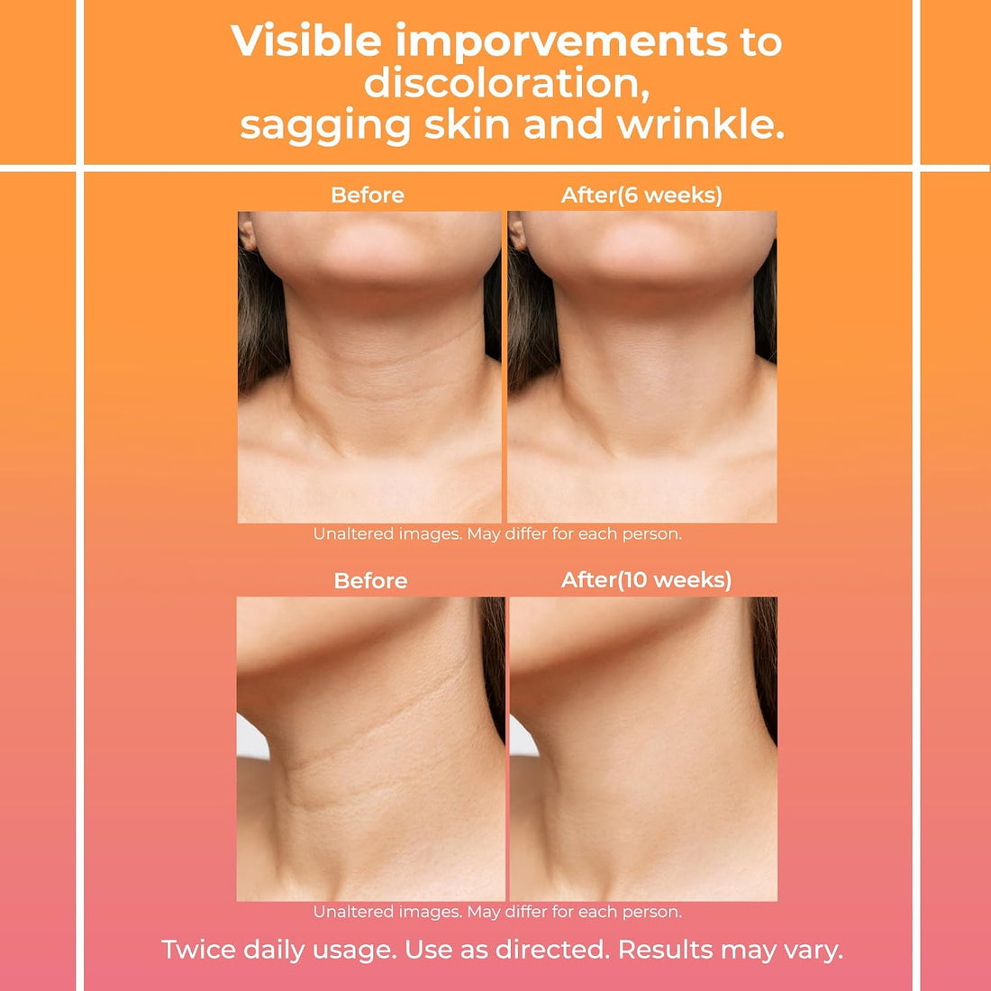 Retinol Neck Firming Tightening Cream: Neck Firming Cream for Women - Retinol Tightening Skin Creams - Anti Wrinkle Aging for Neck & Décolleté