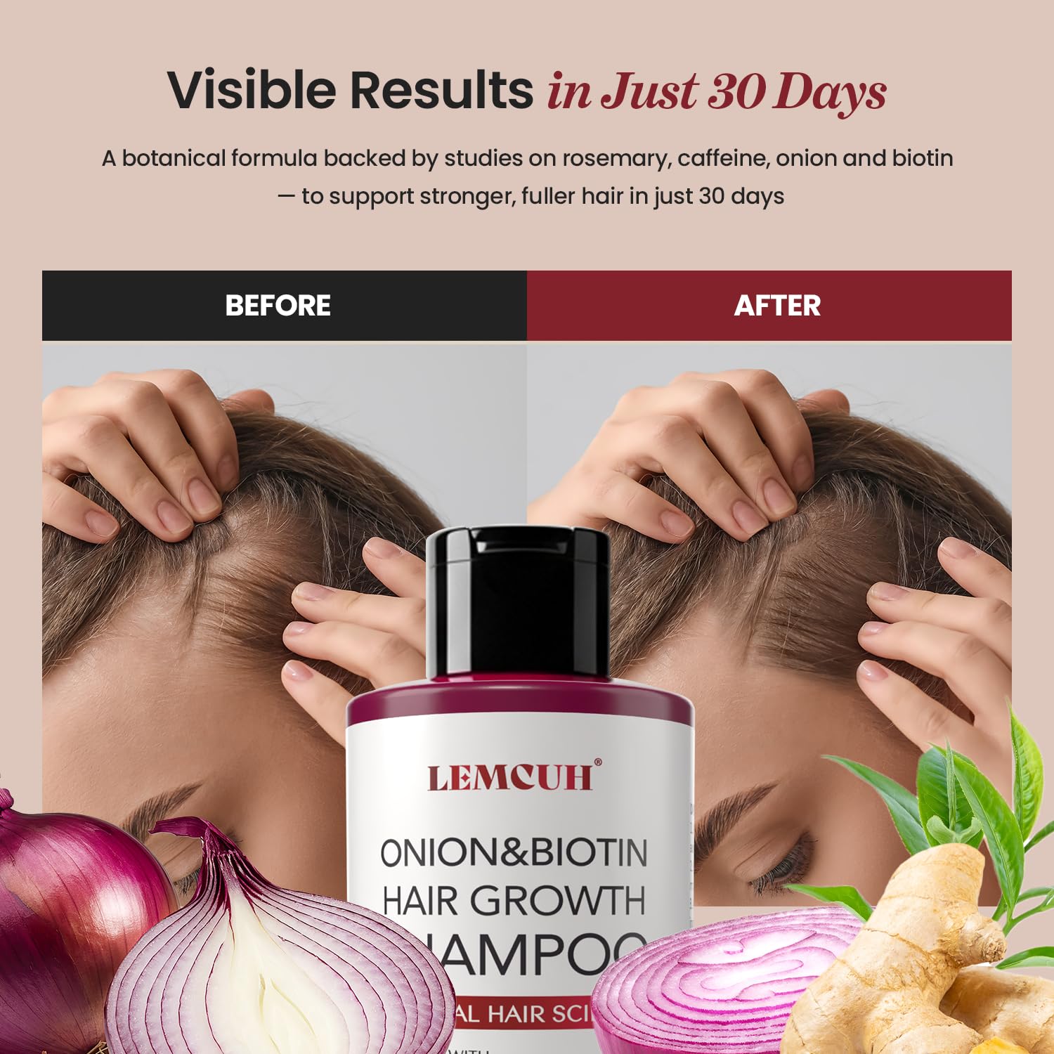 Rosemary Hair Oil and Onion & Biotin Hair Growth Shampoo